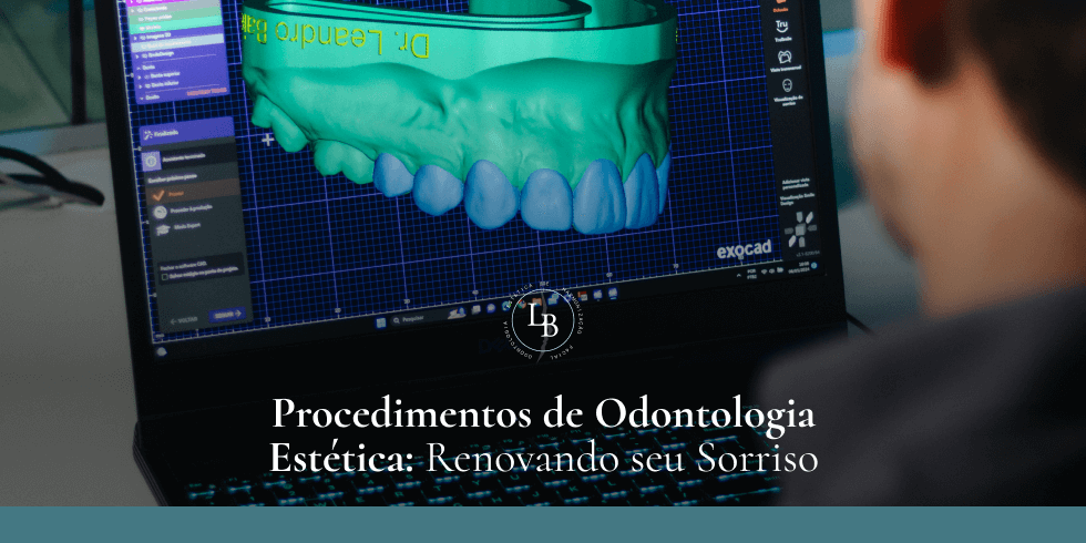 Procedimentos de Odontologia Estética: Renovando seu Sorriso