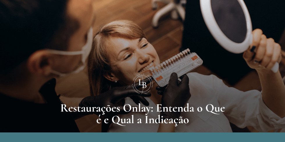 Restauração Onlay: Entenda o Que é e Qual a Indicação