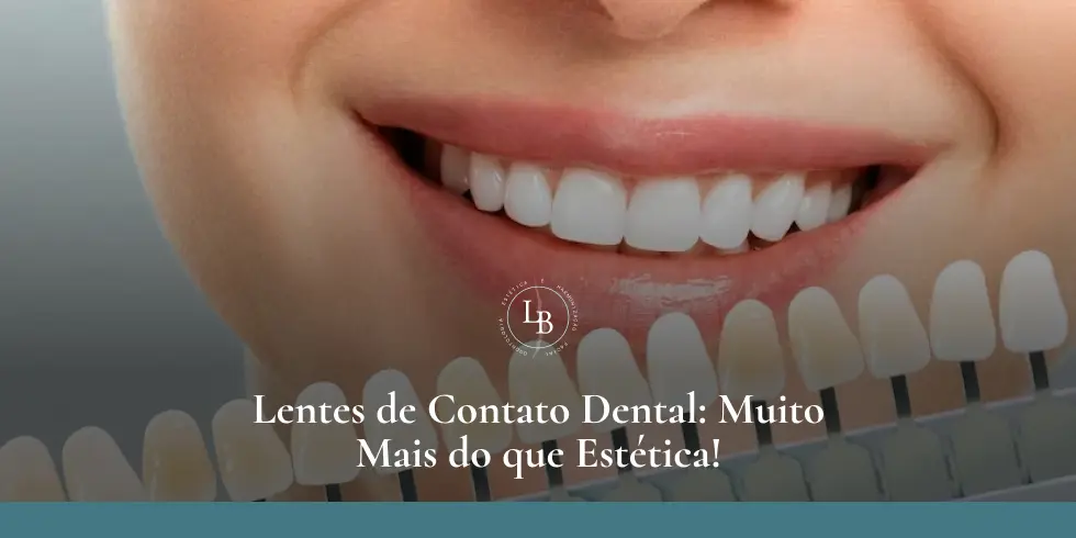 Lentes de Contato Dental: Muito Mais do que Estética!