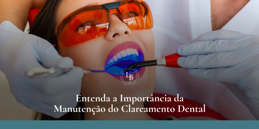 Entenda a importância da manutenção do clareamento dental